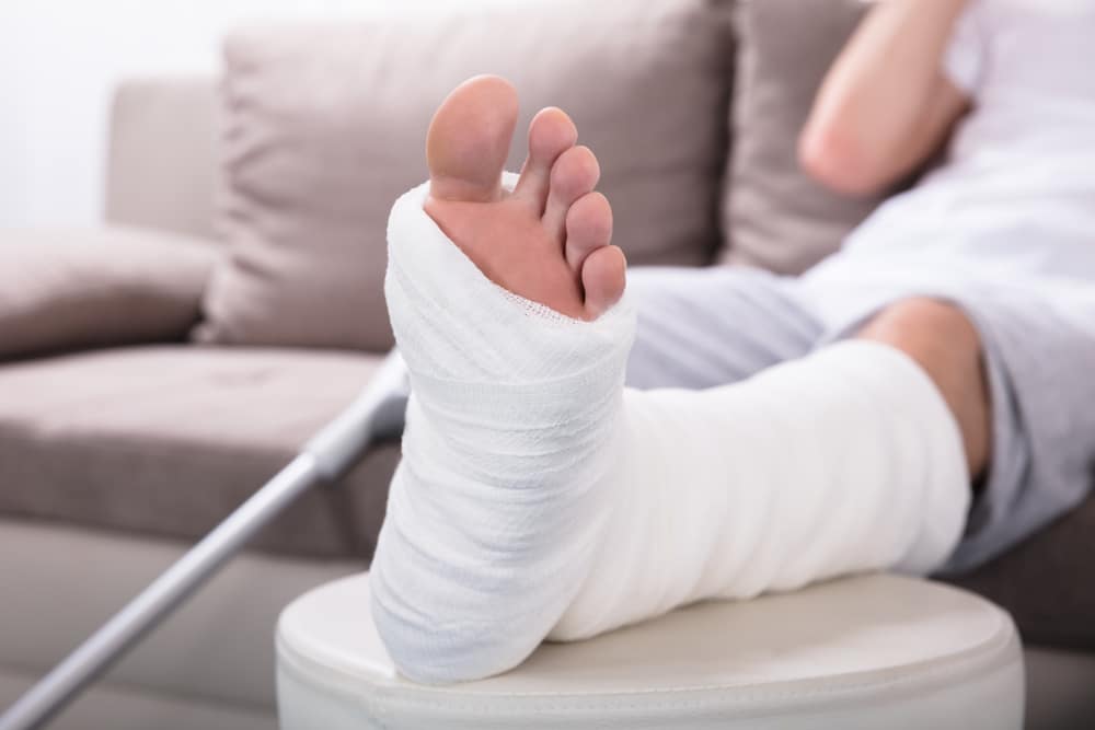 Primer plano del pie y la parte inferior de la pierna de un adulto, con un yeso blanco, elevados sobre un taburete y con unas muletas cerca; el paciente descansa en un sofá tras sufrir una fractura o un esguince a causa de un accidente o una caída.