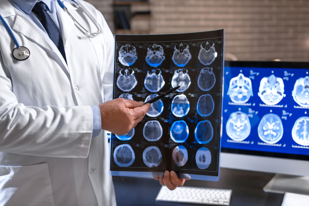Paciente sometido a una tomografía cerebral tras una lesión craneal.